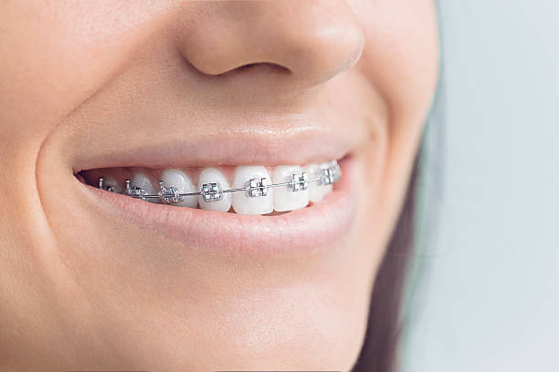 Best Invisalign and Clear Aligners  in New Brunswick, NJ